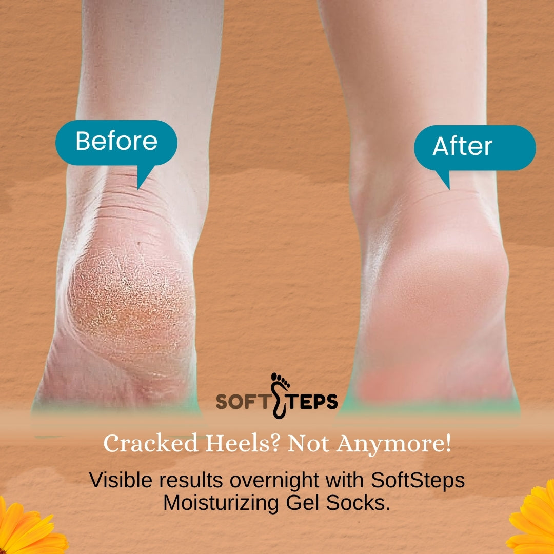 SoftSteps Moisturizing Gel Socks image 6